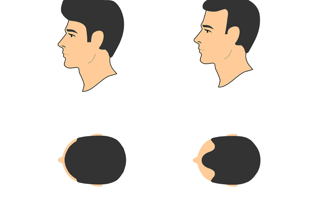 Stage One Subtle Density